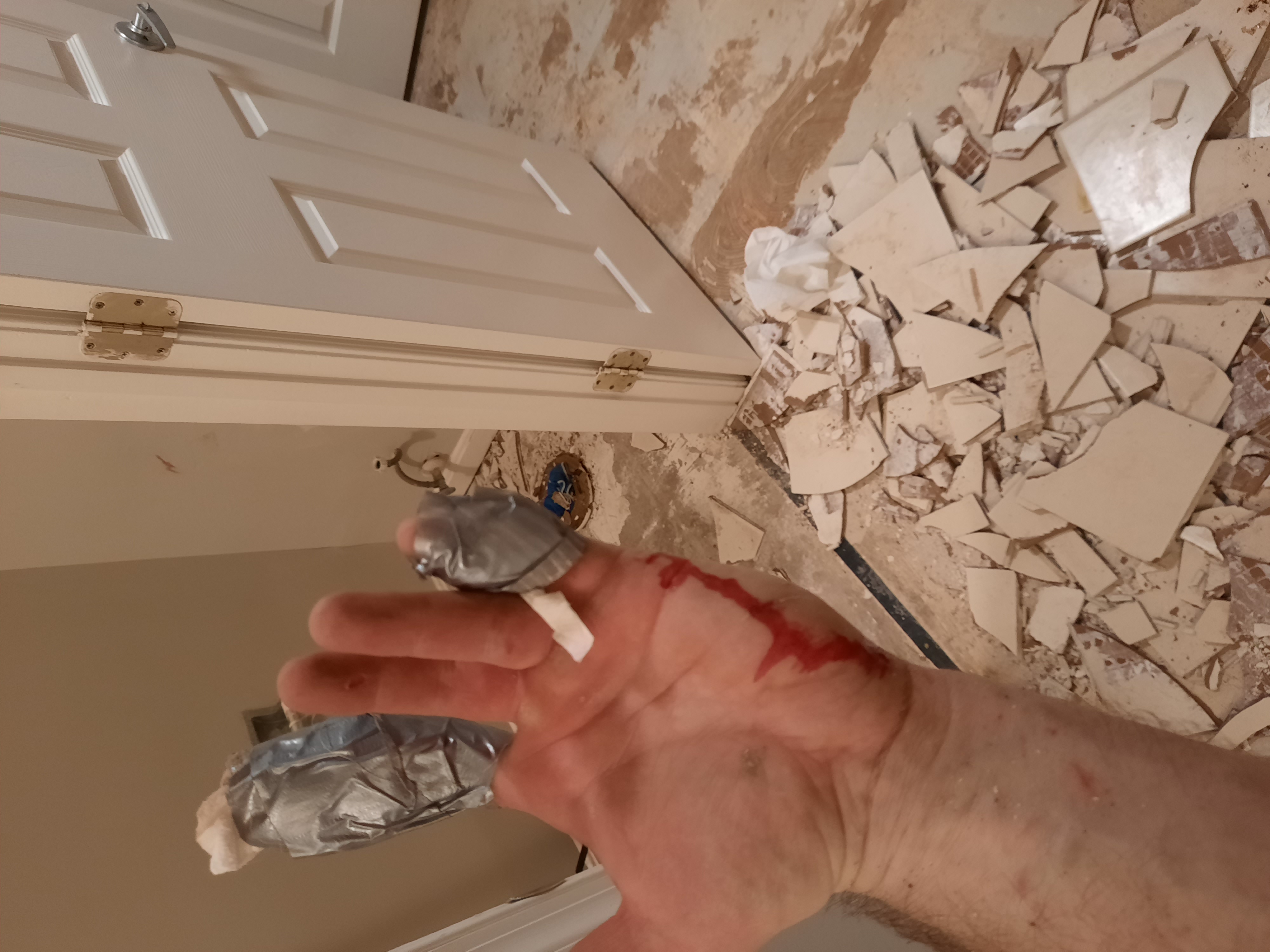 An 'ouch' moment during the job